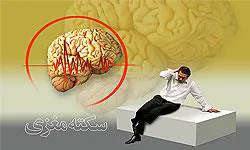 برگزاری جلسات مدیریت سکته های مغزی